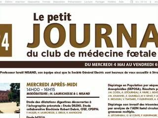Pathologie cardiaque.