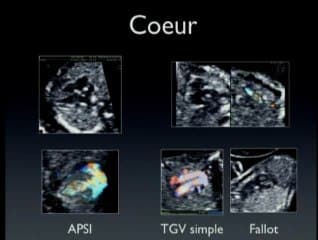 Morphologie foetale au premier trimestre : où s’arrêteront-ils ?