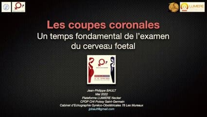Les coupes coronales, un temps fondamental de l'examen du cerveau foetal