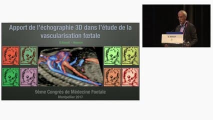 Apport de l’échographie 3D dans l’étude de la vascularisation fœtale.