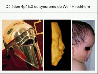 Du RCIU à…