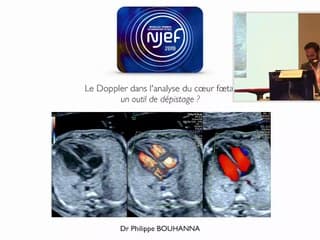 COEUR Le Doppler dans l’analyse du coeur foetal : un outil de dépistage ?