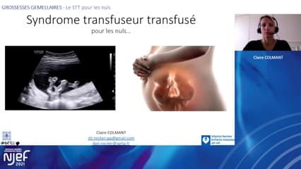 Le STT pour les nuls