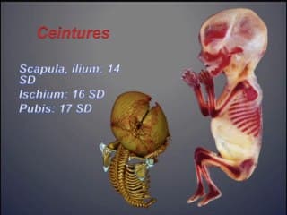 Atelier d'écho-anatomie comparée. L'os foetal