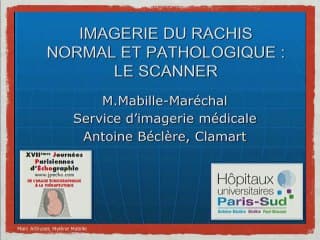 Imagerie du rachis normal et pathologique.