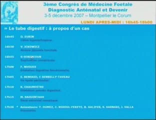 Duplication compliquée