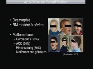 Cardiopathie et CGH array