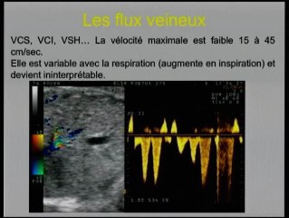 Signification des flux doppler et sites d’étude stratégiques
