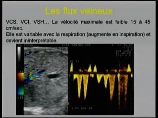 Signification des flux doppler et sites d’étude stratégiques