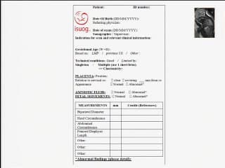 IRM du foetus  ( en ANGLAIS )