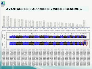 Etude NIMAP ou test Non Invasif de déséquilibre foetal suite à une Malsegregation d'Anomalie Parentale