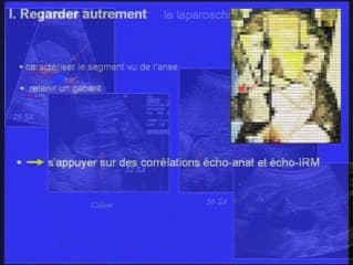 Echographie du tube digestif normal : essayons d'être intelligents.