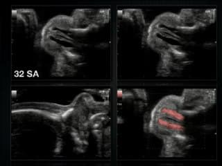 Apport des sondes haute fréquence pour l’étude de la face