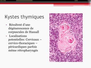 thymus foetal