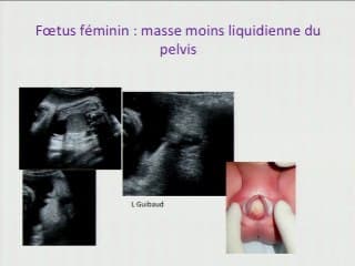 Le rectum dans tous ses états, le fondement des explorations.