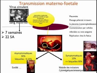 CMV : Pourquoi s'intéresser au CMV ?