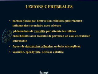 Prise en charge et clinique échographique des infections à CMV
