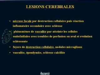 Prise en charge et clinique échographique des infections à CMV