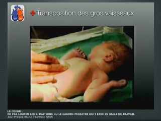 Le cœur : Ne pas louper les situations où le cardio-pédiatre doit être en salle de travail