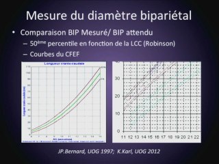 Contribution de l'étude du V4 au diagnostic du spina bifida au 1er trimestre. Etude du CFEF