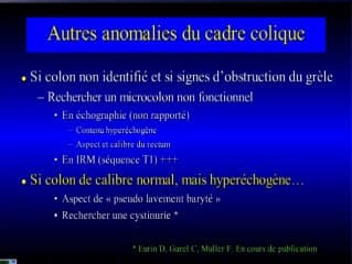 Aspects échographiques de l'obstruction digestive foetale