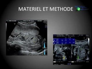 Vers une évaluation standardisée de l'échogénicité intestinale