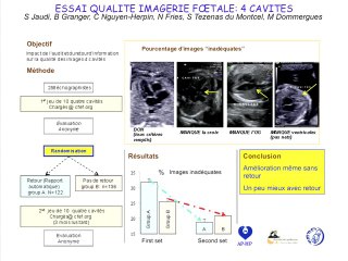 Essais randomisés sur la qualité du dépistage échographie: quelles perspectives?