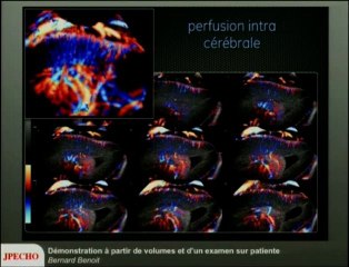 Démonstrations 3D à partir de volumes et d’un examen sur patiente Coeu