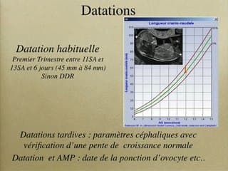 PAG et RCIU « PAG » ou « RCIU » ? Définitions, courbes de référence