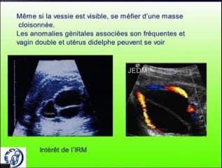 Pathologie du cloaque