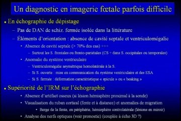 Schizencéphalie : imagerie