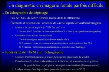 Schizencéphalie : imagerie