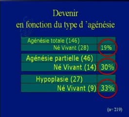 Enquête CFEF : un point sur les agénésies du corps calleux