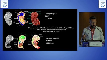 Le cerveau foetal au 1er trimestre