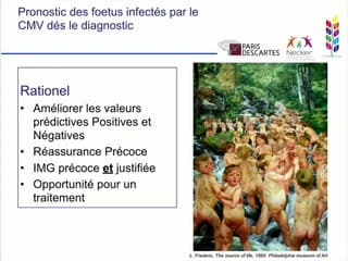 Infections materno-foetales Prédire en prénatal le pronostic des infections à CMV. Place de l'échographie et de l'IRM