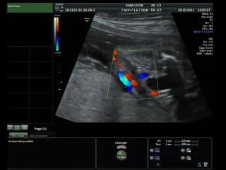 demo live rein  ( en ANGLAIS )