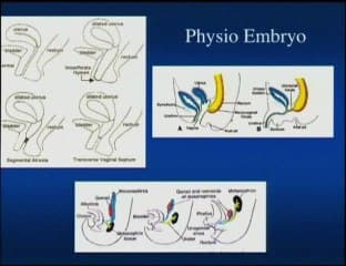 Un kyste particulier : hydrocolpos sur hemivagin borgne