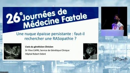 Table ronde sur : une nuque épaisse persistante : faut-il rechercher une RASopathie ?