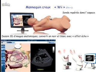 Les simulateurs en échographie