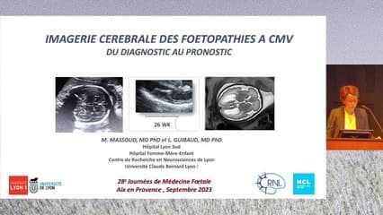 Signes échographiques de fœtopathie à CMV.Du diagnostic au pronostic