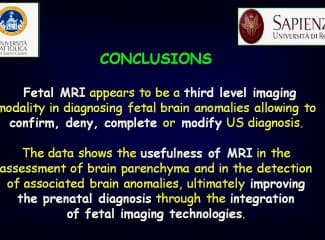 lésion cérébrales ischémo hémorragiques  ( en ANGLAIS )