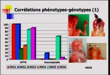 Aspect anténatal des ciliopathies :Hétérogénéité clinique et génétique