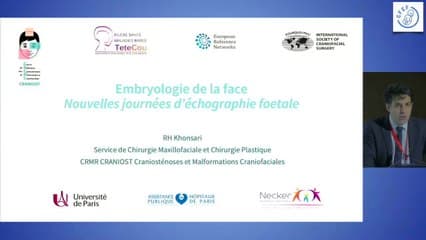 Embryologie de la face