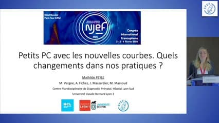 Petits PC avec les nouvelles courbes. Quels changements dans nos pratiques ?