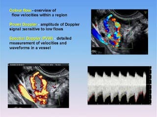 vascularisation ovarienne