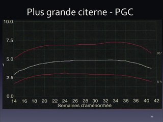 De_marches diagnostiques pour les anomalies de liquide amniotique ? Savoir quantifier, quand ?? Que rechercher sur le ou les foetus en cas d'excès ou d'insuffisance