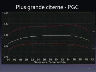 De_marches diagnostiques pour les anomalies de liquide amniotique ? Savoir quantifier, quand ?? Que rechercher sur le ou les foetus en cas d'excès ou d'insuffisance
