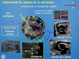 POSTER Oesophage