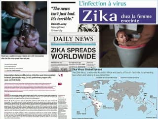 Staffs de dossiers : dossiers cerveau  Pathologie infectieuse : Zika