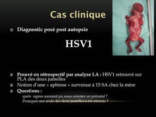 11 RCIU et dilatation digestives: quel diagnostic? HSV1